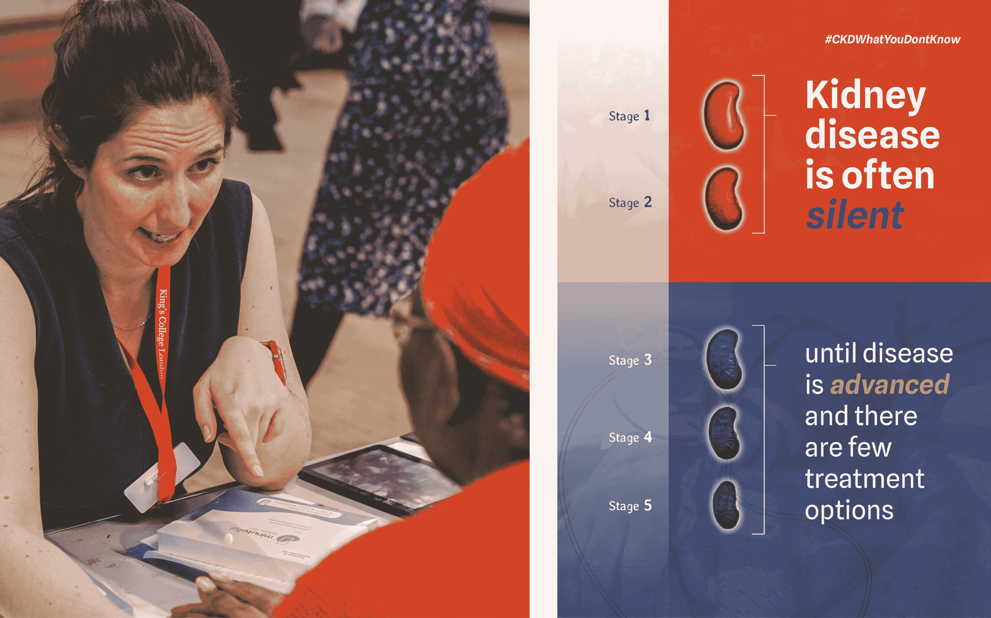 King's College London's Hidden CKD Project: A Multichannel Marketing Campaign for Healthcare Advocacy